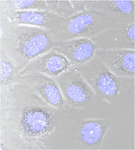 Bladder cells microscopy